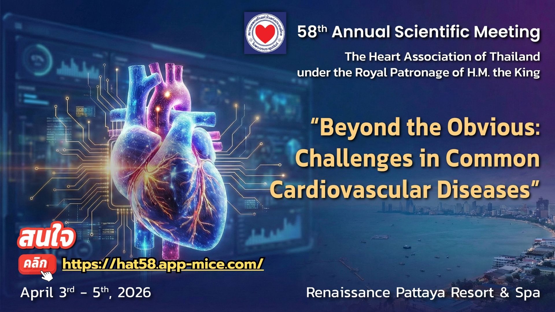 การประชุม 58th Annual Scientific Meeting  "Beyond the Obvious: Challenges in Common Cardiovascular Diseases"